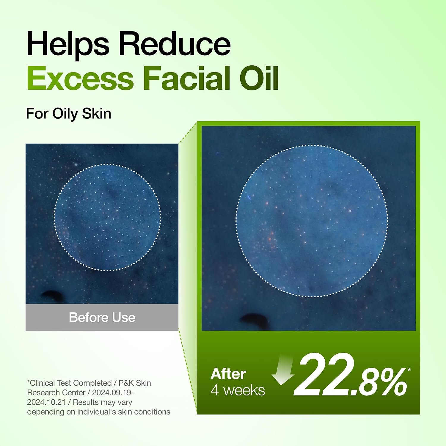 Anua Azelaic Acid 10 Hyaluron Redness Soothing Serum, Facial Serum for Blemish-Prone & Oily-Prone Skin, Lightweight & Hydrating Blemish Care, Hyaluronic Acid, Korean Skincare, 1.01 fl oz. - Image 7