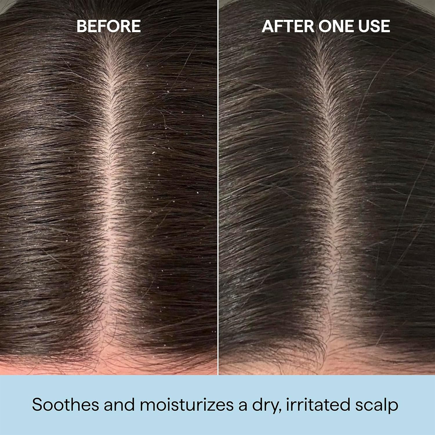 Briogeo Scalp Revival Rosemary Pre-Wash Oil | Moisturizing Scalp Treatment for Dry, Flaky, or Itchy Scalp | Strengthens Hair & Soothes Scalp | Vegan & Cruelty-Free - Image 2