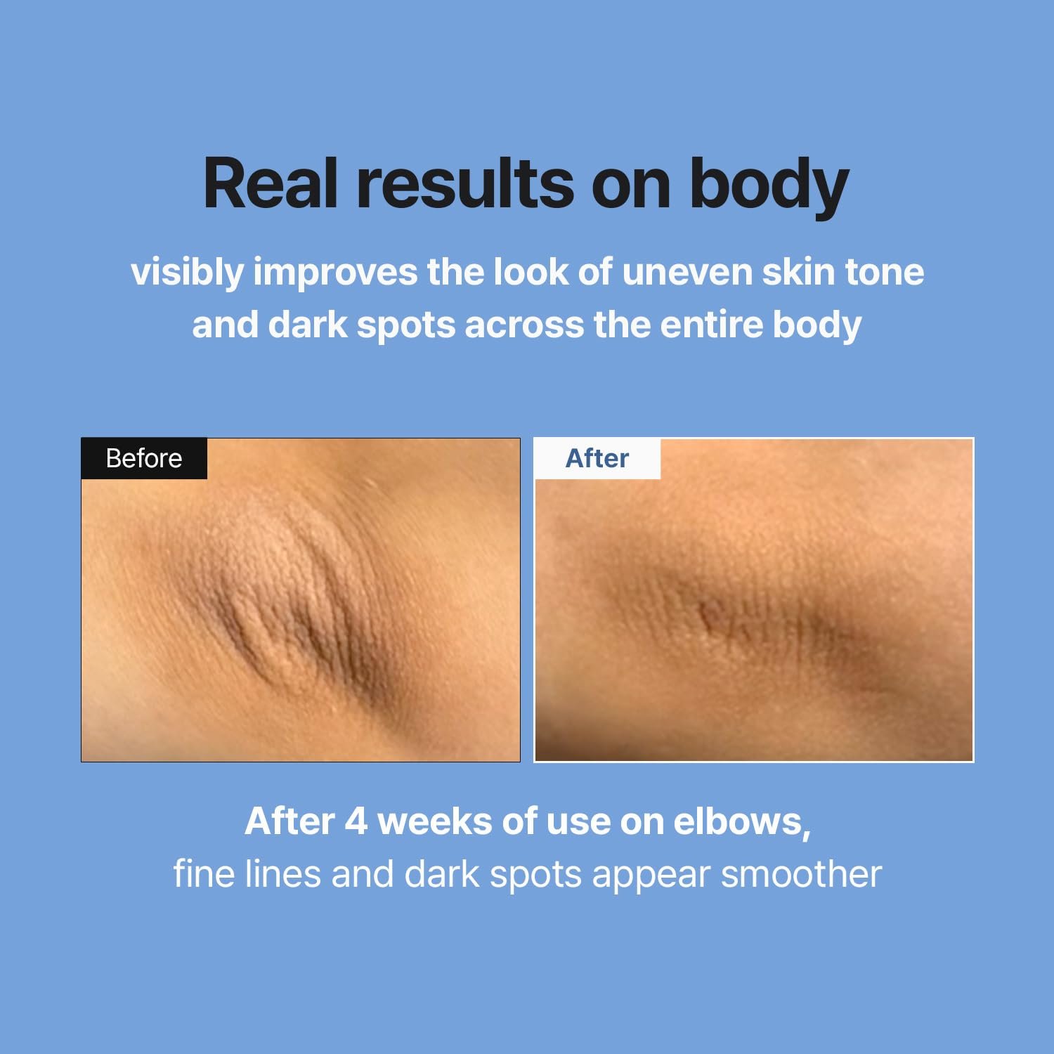 MEDITHERAPY Retinal Skin Booster Serum | Retinaldehyde, Niacinamide Anti-Aging Serum - K-Beauty Facial Serum for Fine Lines, Firming & Radiance | Hydrating Face Serum All Skin Types, 5.07 fl oz - Image 4
