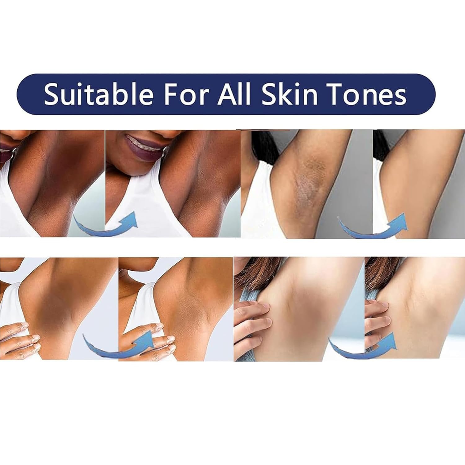 Skin Bleaching Cream Skin Lightening for Body Intimate Areas, Private Parts, Underarm, Knees, Elbows, Inner Thigh, Bikini Area, Whitening Cream Dark Spot Remover For Intimate Areas (1FL OZ) - Image 4