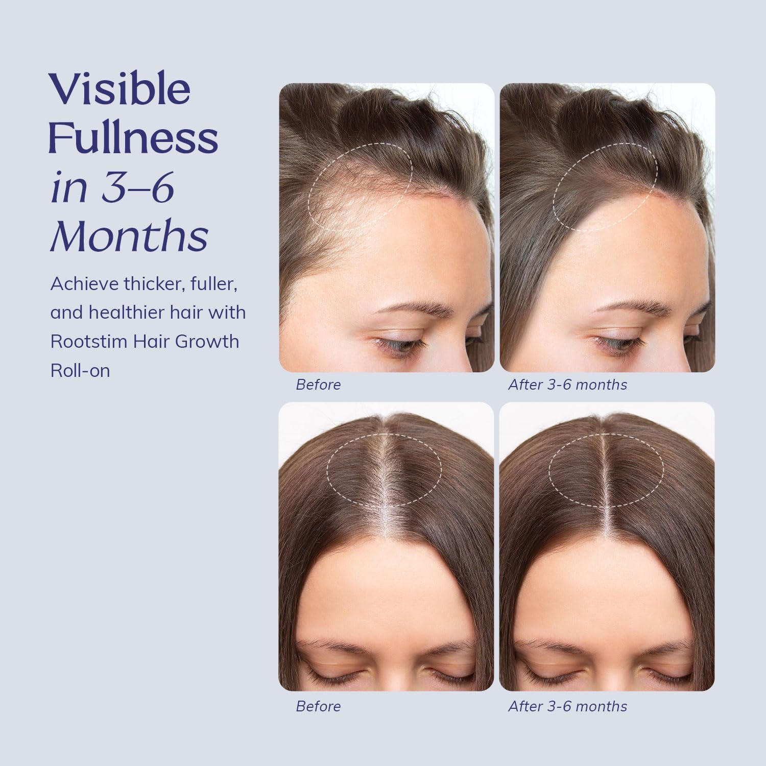 Hair Growth Serum Roll On with Rosemary, Caffeine & Biotin, Helps Support Fuller-Looking Hair, Clean Non-Greasy Scalp Serum for Thinning Hair 1.08 Fl Oz - Image 6