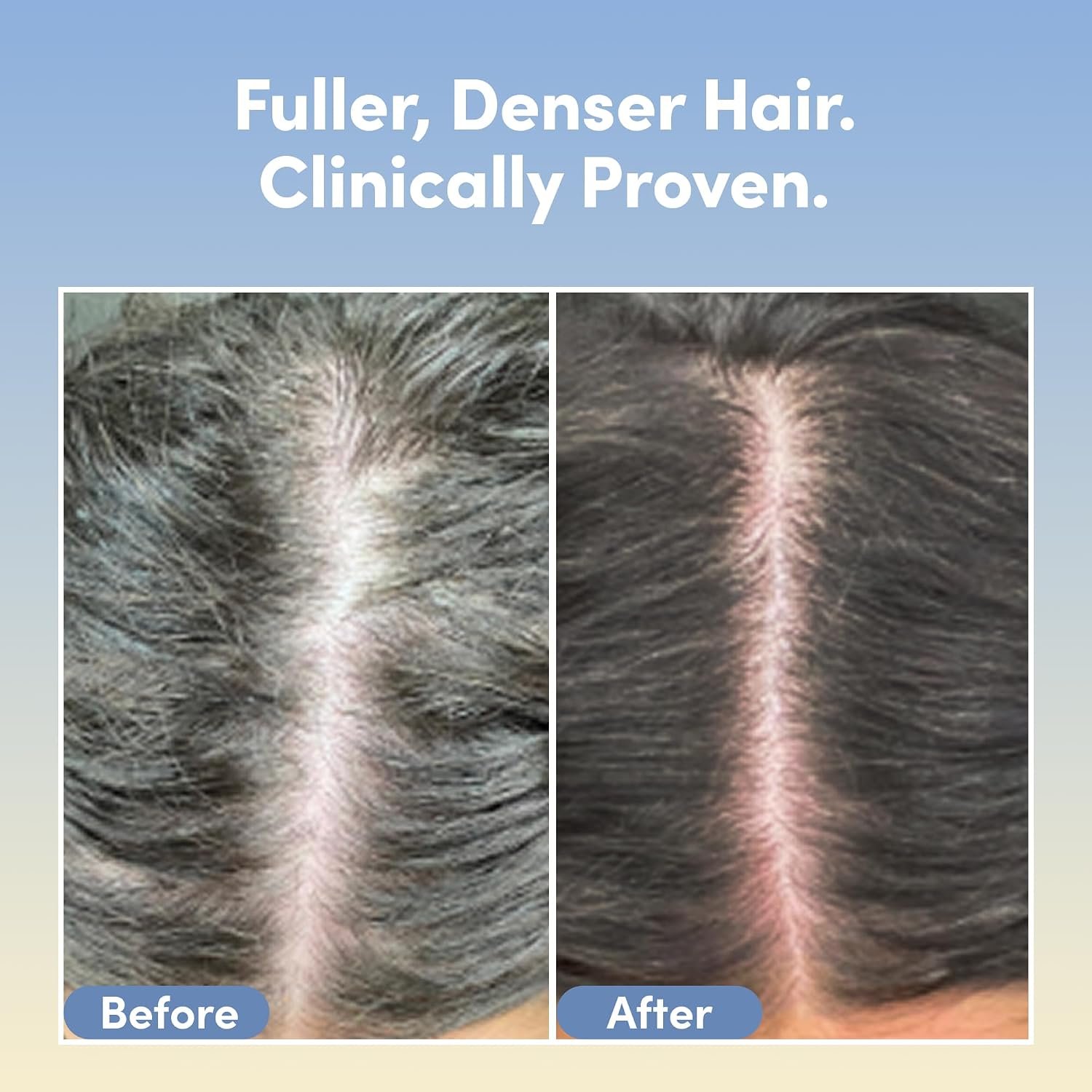 Coco & Eve Boost Therapy Tripeptide Hair Density Serum. For Thicker, Fuller Hair. Anti-Hair Loss & Shedding, Lightweight Scalp Treatment with Biotin & Caffeine for Volume & Restoration (2.03 Fl Oz) - Image 2