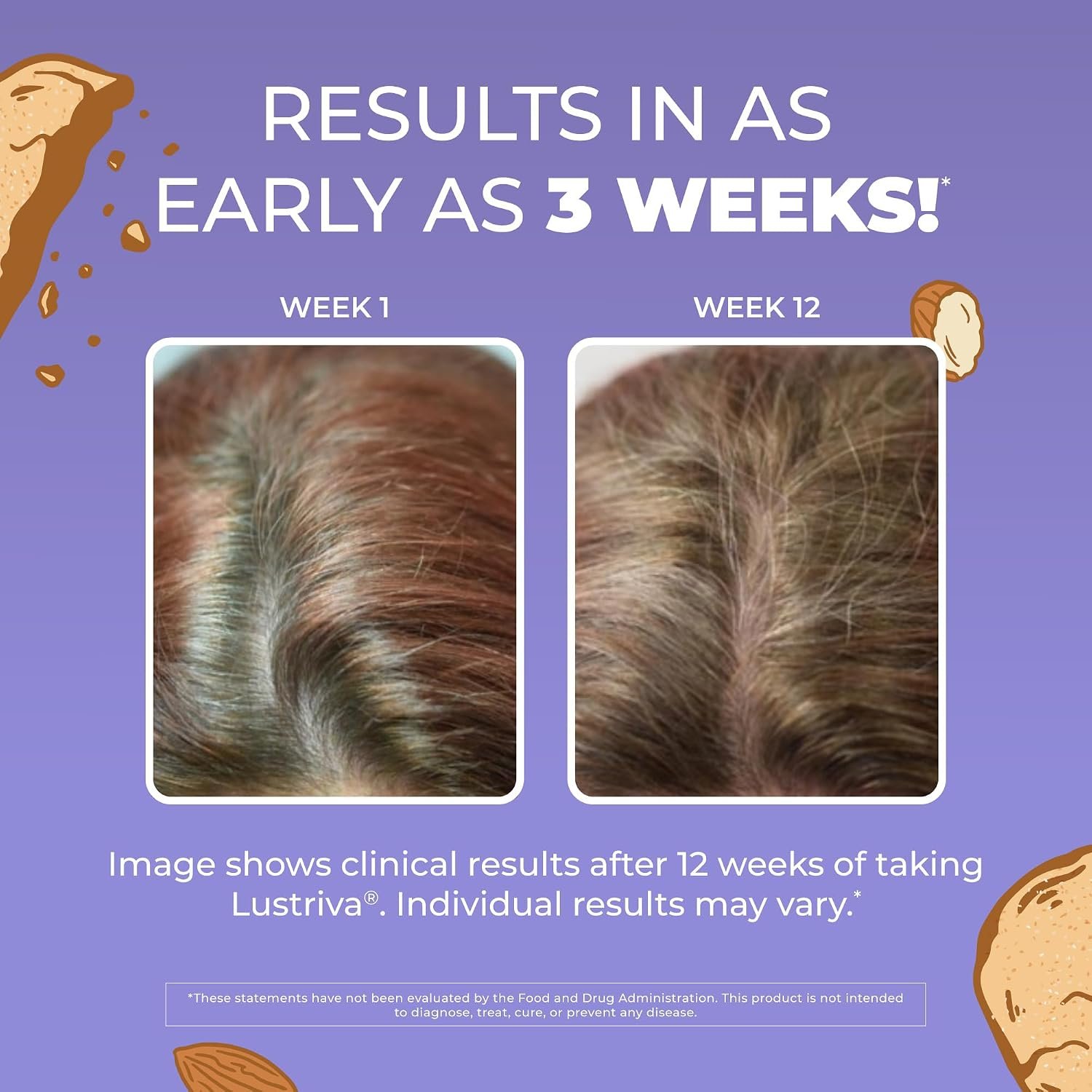 MaryRuth's Hair Growth Max Liposomal for Women | Lustriva® + Biotin 10000mcg + Pumpkin Seed Oil | Thicker Hair | Hair Care | Wrinkles, Fine Lines, Skin Care | Ages 18+ | CLP Certified | 15.22 Fl Oz - Image 3