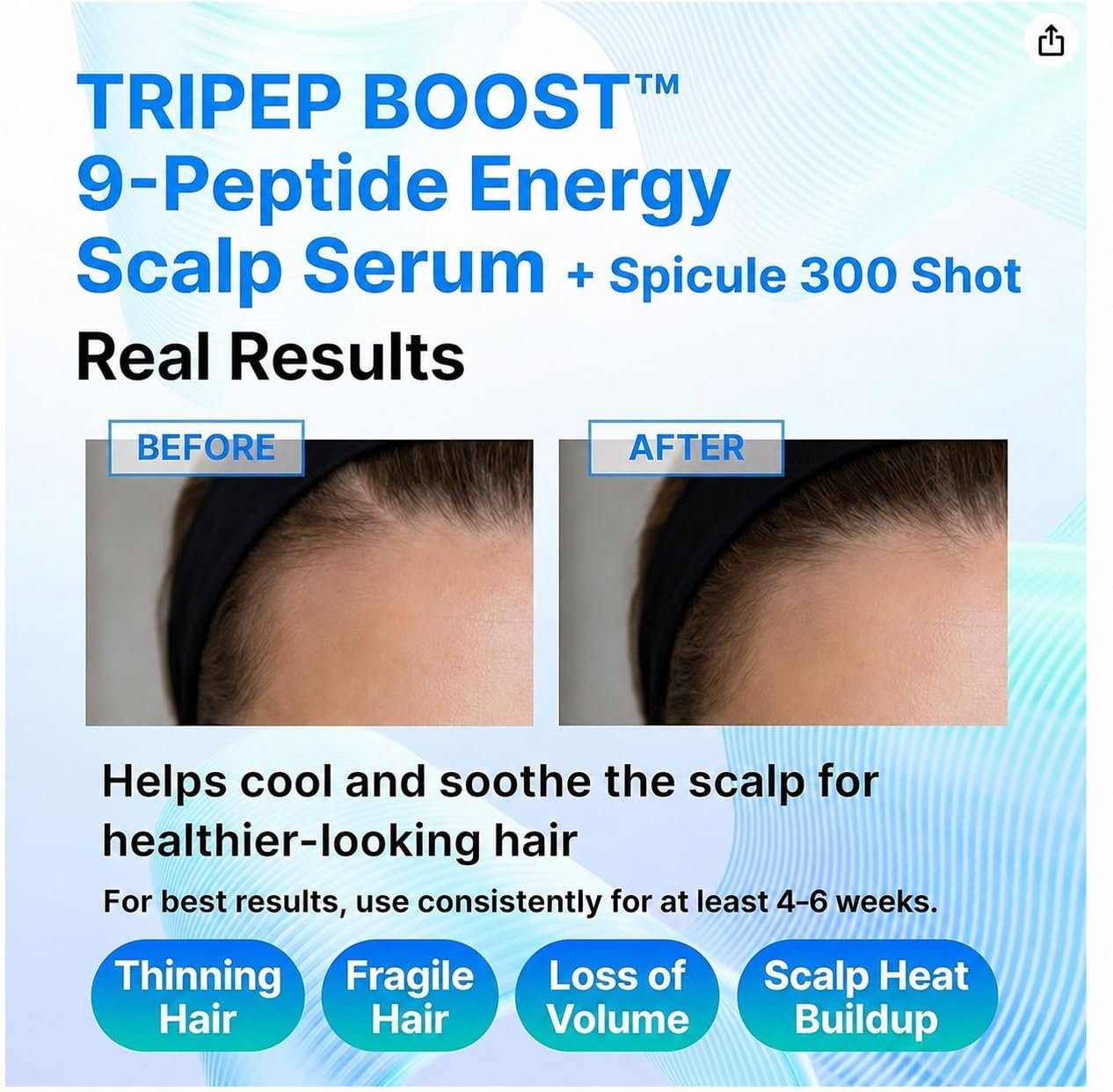 9-Peptide Hair Growth Scalp Care Serum 1.35 Oz(2X Size) - Rosemary 2% Caffeine 1% PDRN & Spicule 300 Roll-On Type | Thicker Fuller-looking Hair w/Niacinamide Zinc PCA | Thinning hair Korean Haircare - Image 5