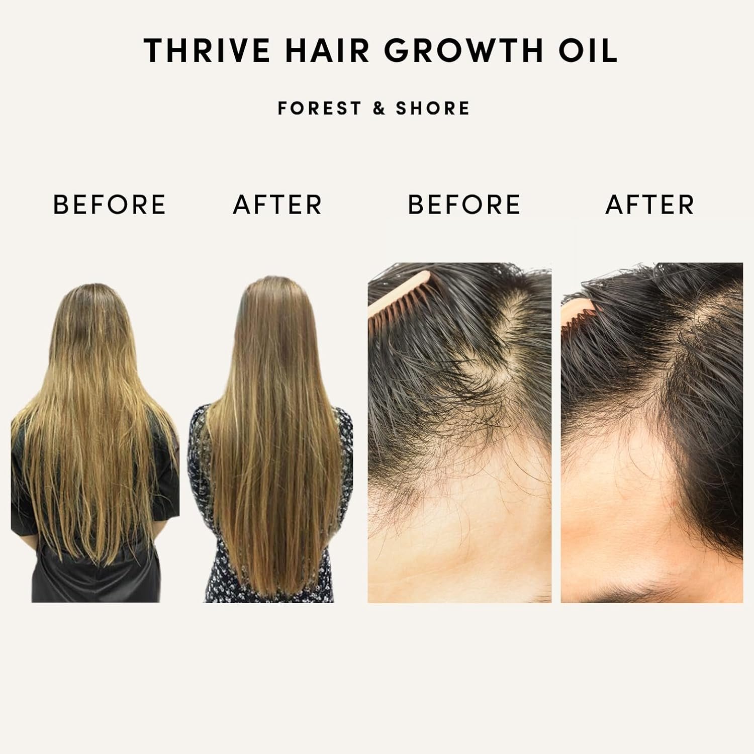 Forest & Shore Hair Growth Oil, 100% Natural, with Caffeine, Biotin, Castor , Argan & Rosemary, Effective Serum for Damaged Hair - Image 2