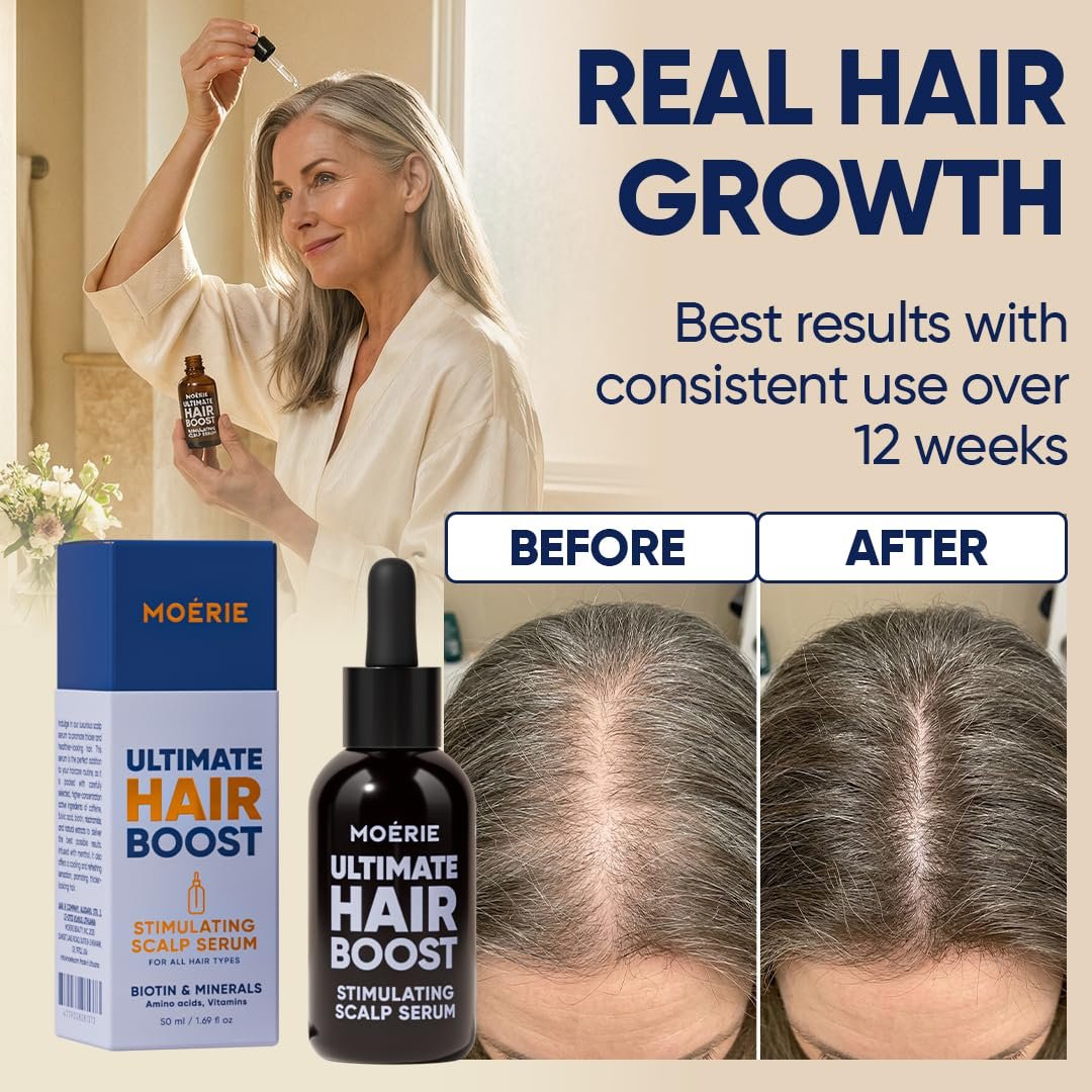 MOERIE Ultimate Hair Growth Serum for Natural Hair Regrowth & Thickening - Anti Thinning & Hair Loss Treatment for Women - Rapid Hair Growth Products - Scalp Oil Alternative - 1.69 fl oz / 50 ml - Image 4