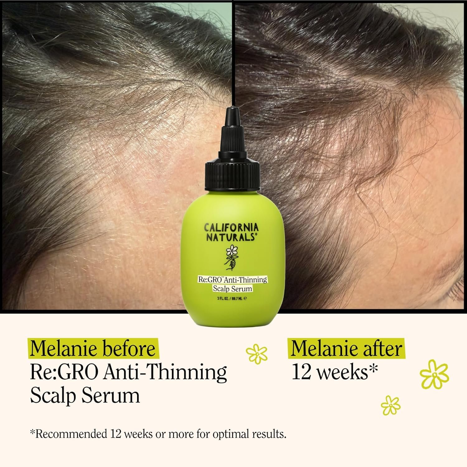 California Naturals Women's Re:GRO Anti-Thinning Scalp Serum, 5% Capixyl with Biotin, Caffeine & Castor and Rosemary Oil, Non-Sticky Cooling Formula, Vegan & Cruelty Free, 3oz - Image 2