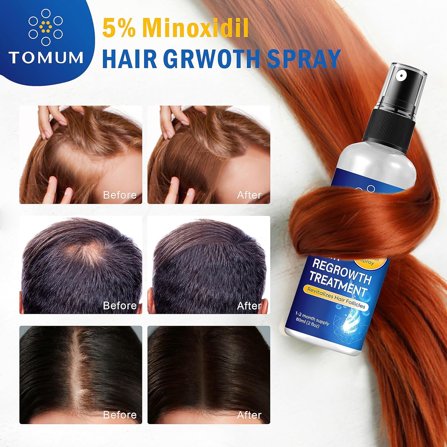 Minoxidil for Men and Women Hair Growth: 5% Minoxidil Topical Spray Hair Regrowth Treatment Stop Hair Thinning and Hair Loss For Stronger Thicker Longer Hair 60ml 2 Pack - Image 7