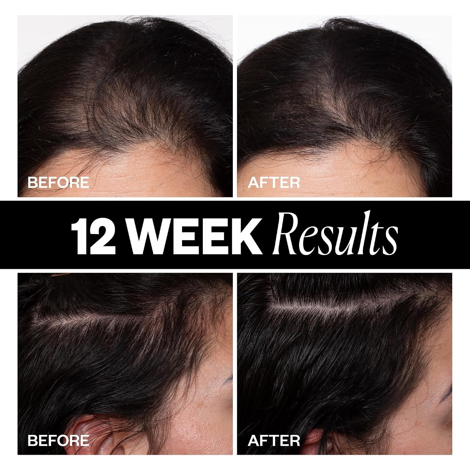 IGK SPONSORED Scalp Treatment for Hair Growth | Thickening Serum for Thinning Hair | Clinically Tested Mist for Hair Density and Volume | 2.1 Oz - Image 4