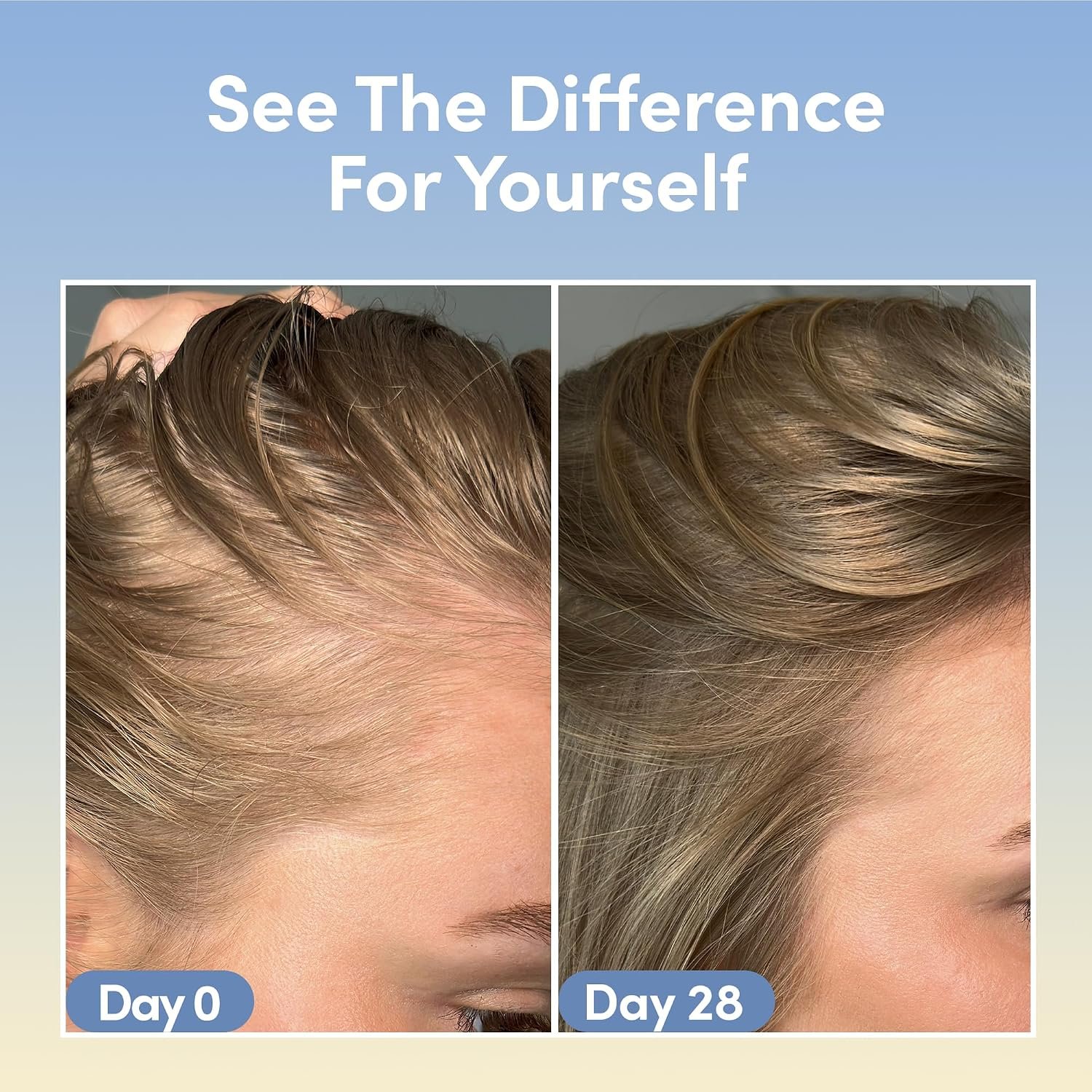 Coco & Eve Boost Therapy Tripeptide Hair Density Serum. For Thicker, Fuller Hair. Anti-Hair Loss & Shedding, Lightweight Scalp Treatment with Biotin & Caffeine for Volume & Restoration (2.03 Fl Oz) - Image 3