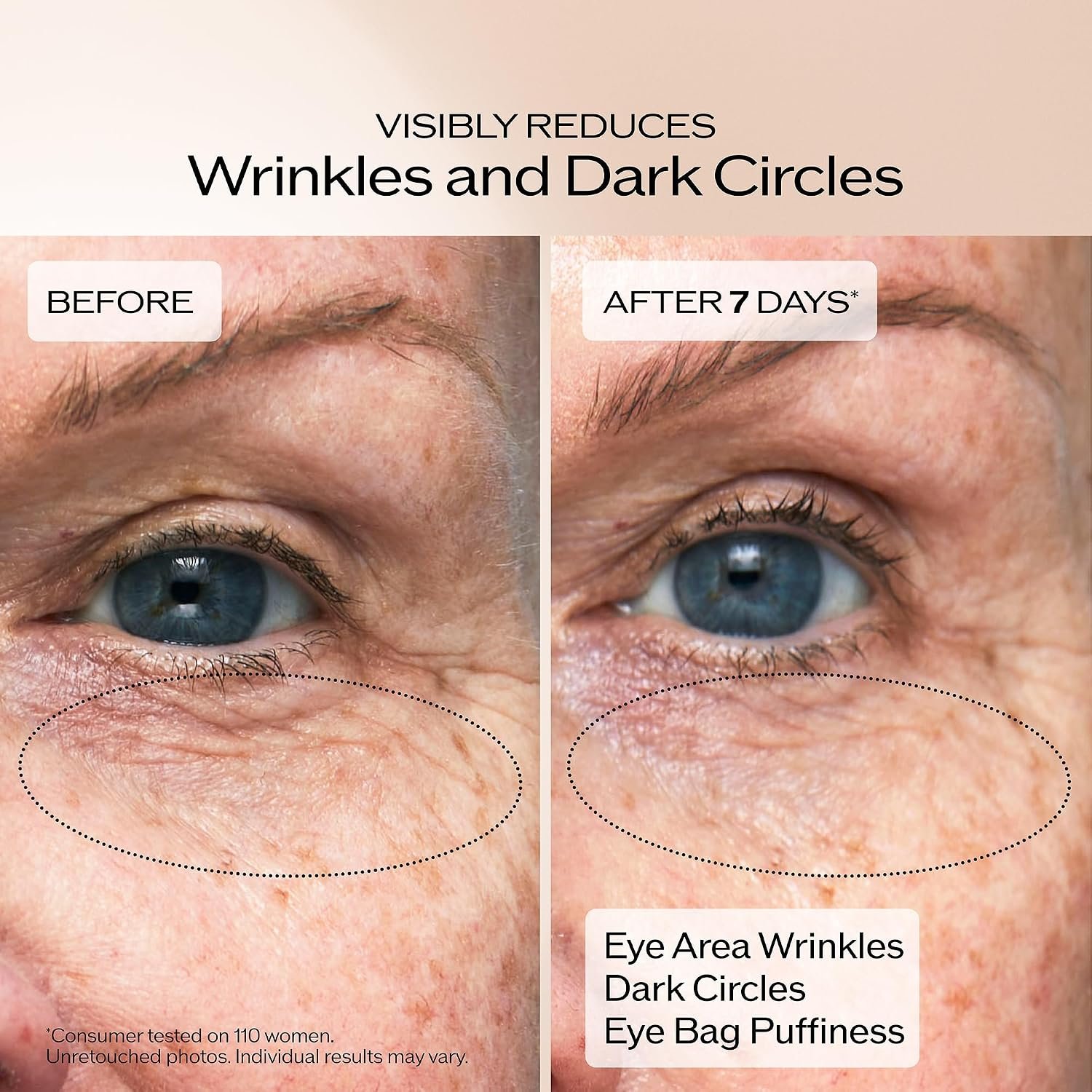Shiseido Benefiance Wrinkle Smoothing Eye Cream - 15 mL - Visibly Improves Five Types of Eye Wrinkles, Dark Circles & Puffiness - 48-HR Hydration - All Skin Types - Non-Comedogenic - Image 3