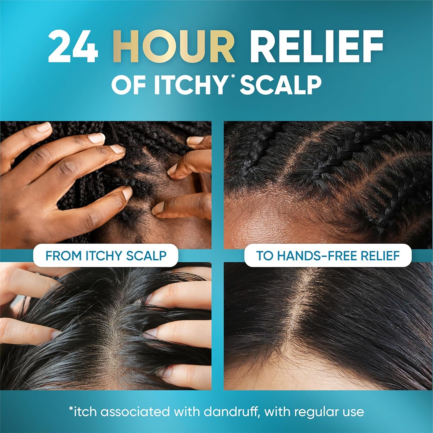 Head & Shoulders Royal Oils Scalp Elixir Treatment, Formulated with Cooling Menthol and Peppermint Oil for Instant Scalp Soothe and Hydration, 4.2 fl oz - Image 4