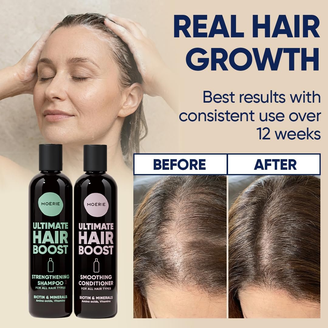 Moerie Hair Growth Shampoo and Conditioner for Women and Men, Hair Loss Solution with Biotin and Rosemary, Thickening Shampoo and Conditioner for Thinning Hair – Promotes Regrowth - Image 4