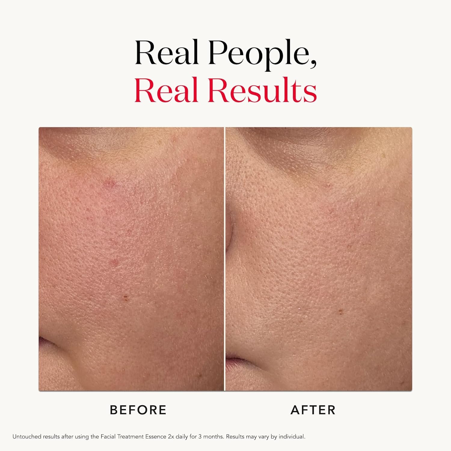 SK-II Facial Treatment Essence - Anti-Aging Essence Skincare to Help Reduce the Appearance of Fine Lines & Wrinkles - Visibly Refines Texture & Improves Firmness & Dark Spots - Image 8