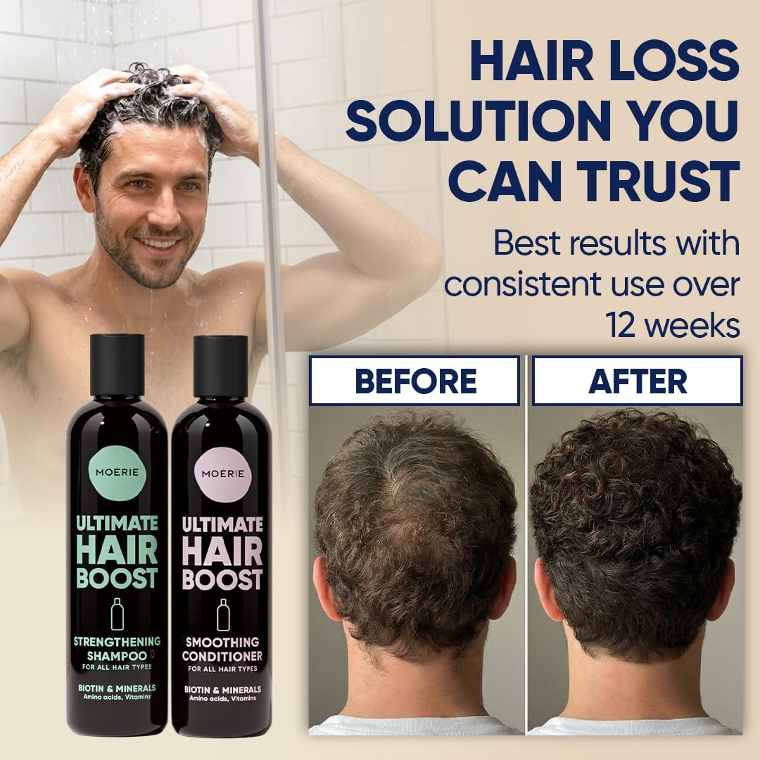 Moerie Hair Growth Shampoo and Conditioner for Women and Men, Hair Loss Solution with Biotin and Rosemary, Thickening Shampoo and Conditioner for Thinning Hair – Promotes Regrowth - Image 5