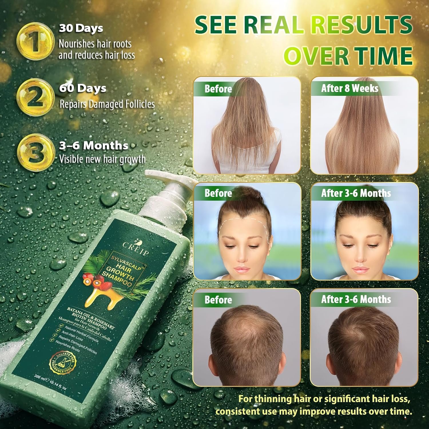 Rosemary & Batana Oil Hair Growth Shampoo: Hair Loss Shampoo for Men and Women with Biotin, Sulfate & Fragrance-Free Thickening - Image 5