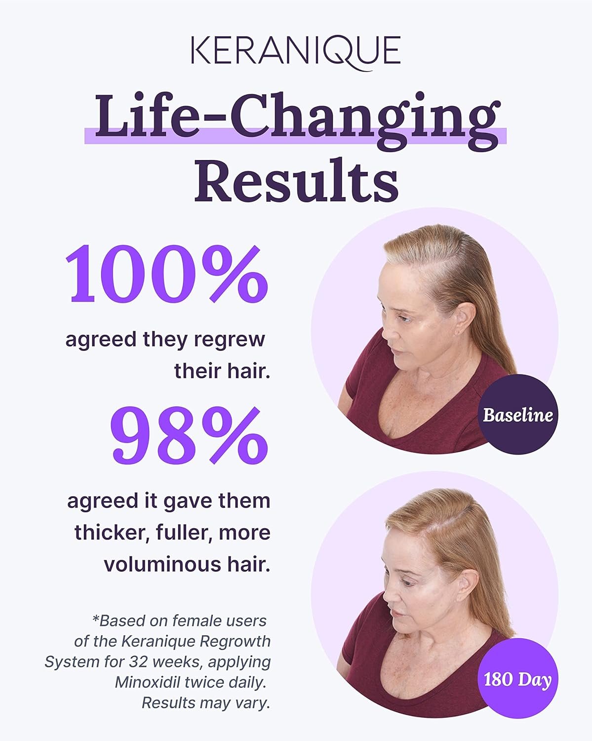 Keranique Hair Regrowth Treatment for Women - 2% Minoxidil for Hair Growth & Thickening - Topical Solution Scalp Treatment for Hair Loss & Thinning w/ Precision Spray Applicator - 2 Fl Oz - Image 3