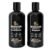 Minoxidil Shampoo & Conditioner Set for Hair Growth – Biotin, Ginseng & Ginger – Supports Thicker, Fuller Hair – Scalp Care Formula – For Men & Women – 600ml Duo
